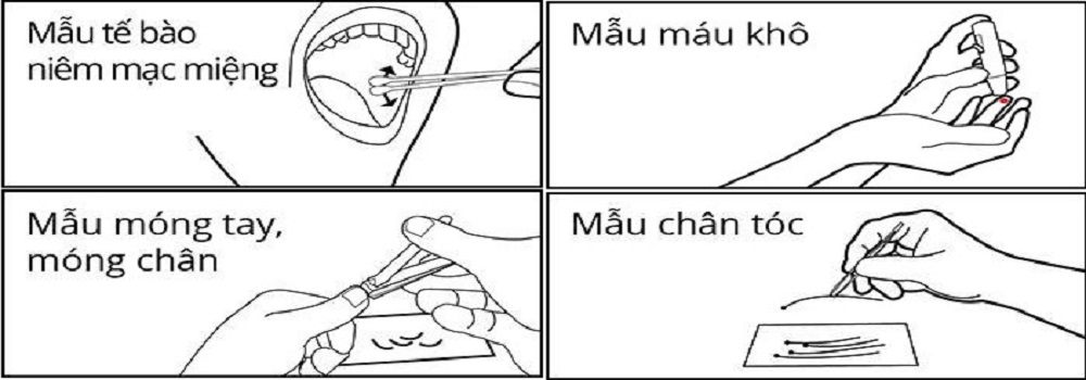 Xét nghiệm sàng lọc trước sinh không xâm lấn NIPT, Xét nghiệm sàng lọc trước sinh không xâm lấn NIPT